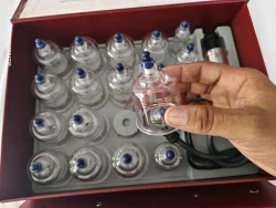 Korean Cupping Set